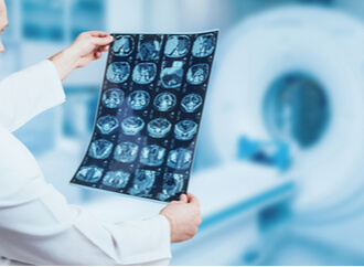 doctor examining brain scans