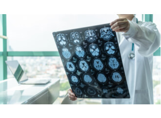 Doctor examining head x-rays of a brain injury patient.